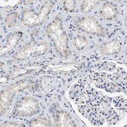Importin-8 Antibody, Novus Biologicals 0.1mL; Unlabeled:Antibodies, Polyclonal